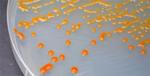 Colonias de Polaribacter en una placa de Petri (el color naranja se debe a los carotenoides). Fuente: PNAS.